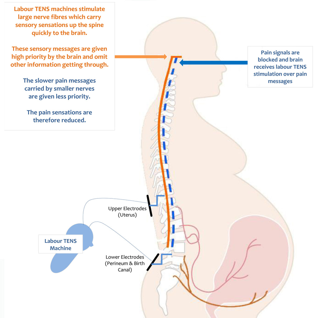 http://www.tenshire.co.nz/cdn/shop/articles/How_TENS_blocks_sharp_pain_reaching_the_brain_for_facebook_1024x1024.jpg?v=1565061045